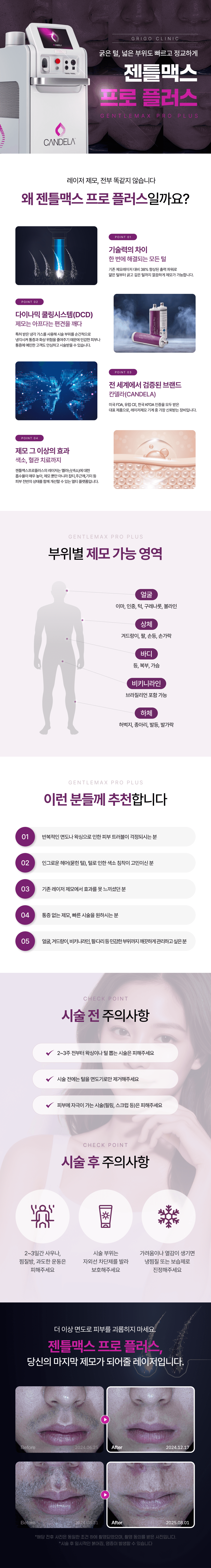 [젠틀맥스프로플러스] 남성제모