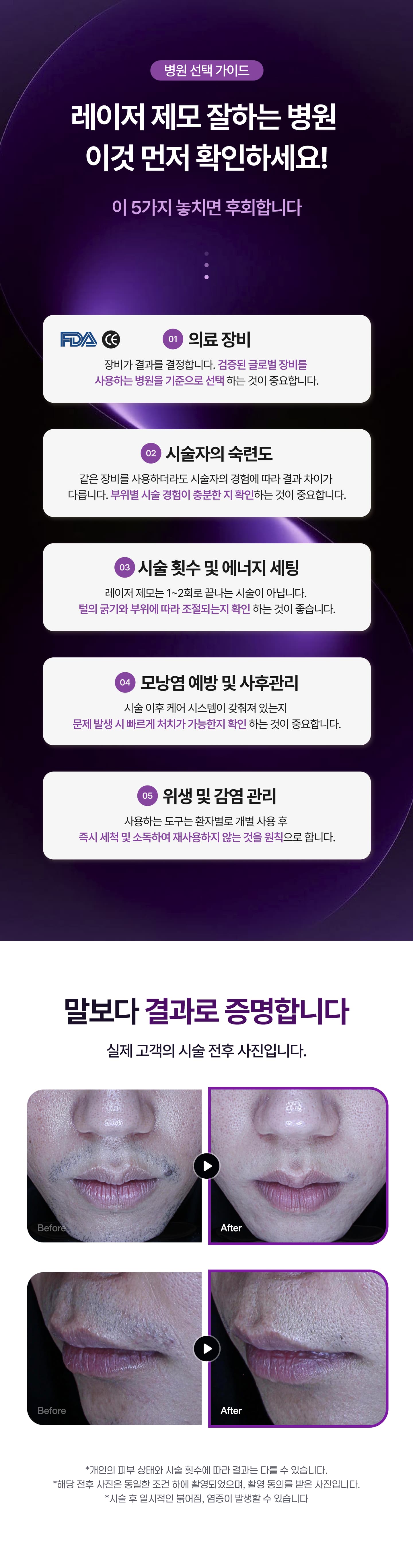 [젠틀맥스프로플러스] 여성제모